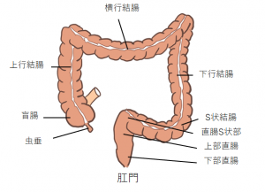 大腸がん01