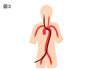 AN_figure3