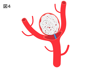 AN_figure4